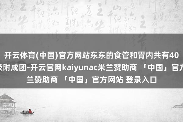 开云体育(中国)官方网站东东的食管和胃内共有40颗磁力珠彼此吸附成团-开云官网kaiyunac米兰赞助商 「中国」官方网站 登录入口